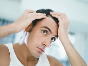 Causes of hair loss in men